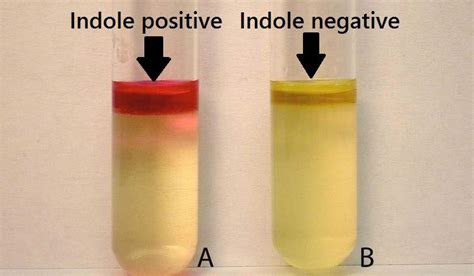 Which bacteria is indole positive?