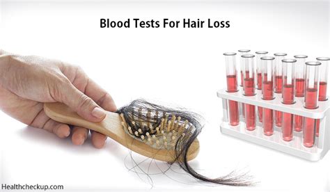 Which blood test is required for hair loss?