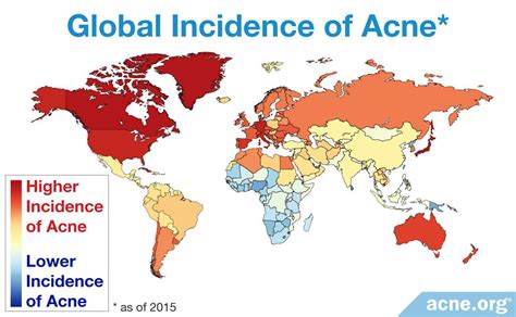 Which country has most acne?