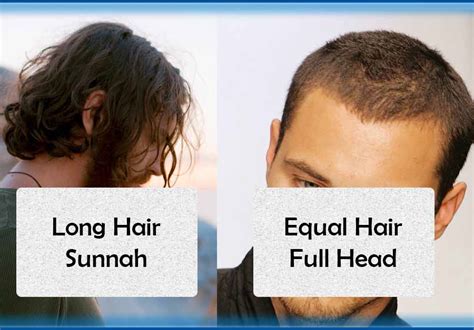 Which hair is halal?