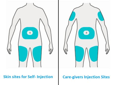 Which injection hurts the least?