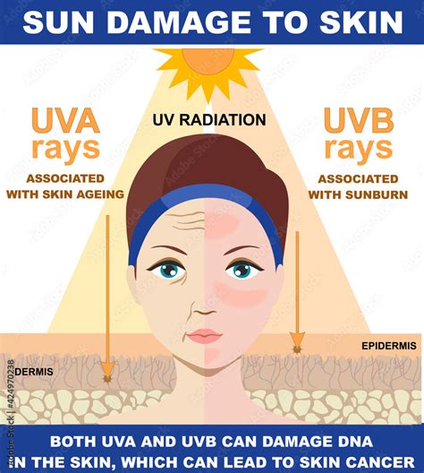 Which is harmful UVA or UVB?