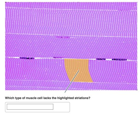 Which muscle type lacks striations?