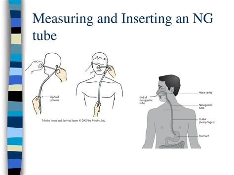 Which of the following actions should you perform first in preparation for inserting the NG tube?