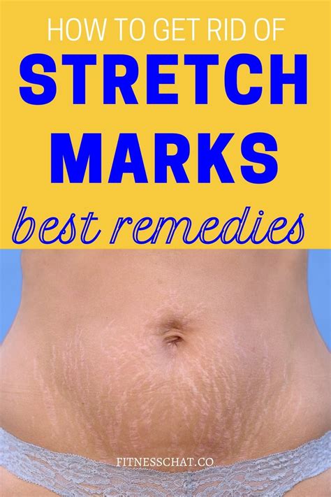 Which oil removes stretch marks fast?