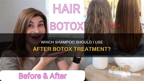 Which shampoo to use after botox?