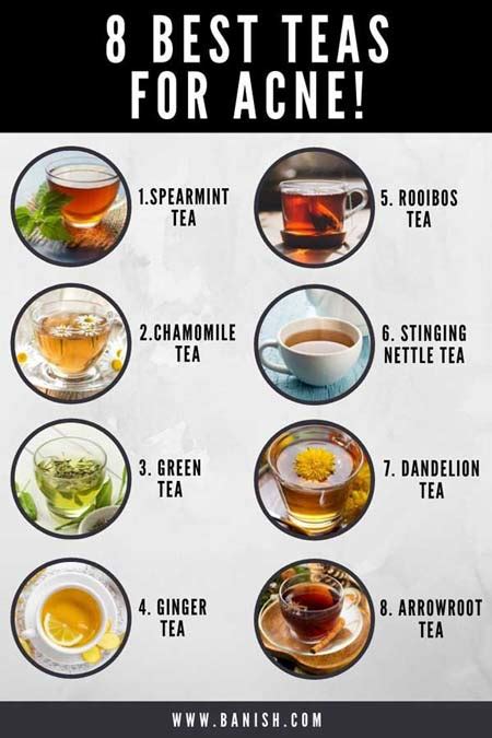 Which tea is best for pimples?