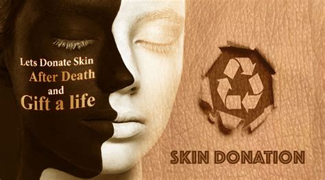 Who Cannot donate skin?