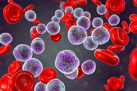 Who is at high risk for leukemia?