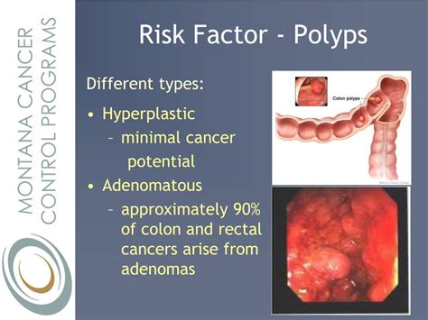 Who is at highest risk for colon polyps?