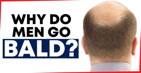 Who is least likely to go bald?