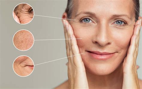 Who is more prone to wrinkles?