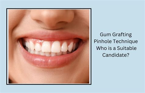 Who is not a good candidate for gum grafting?