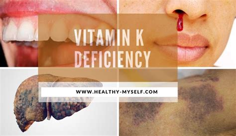 Who should not take vitamin K?
