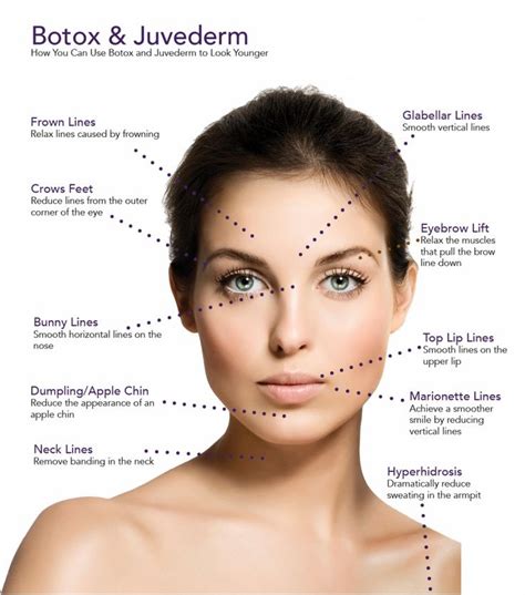 Who should not use Botox?