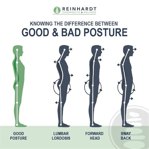 Who treats bad posture?