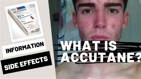 Why Accutane is not worth it?