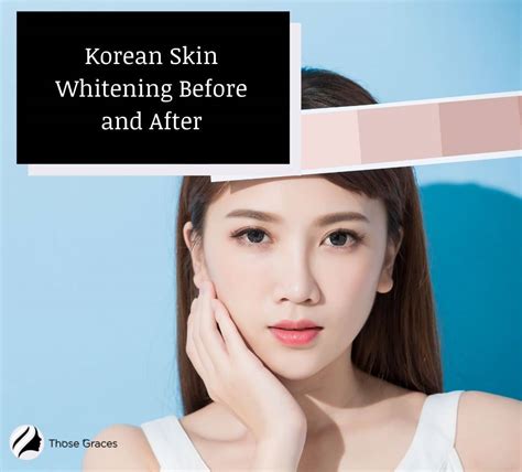 Why Korean skin is so beautiful?