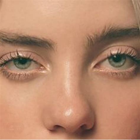 Why are Billie's eyes like that?