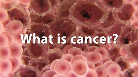 Why are Cancers so secretive?