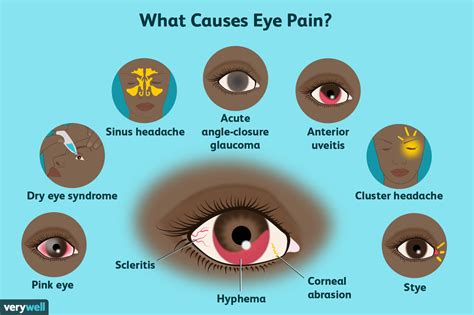Why are eye injuries so painful?