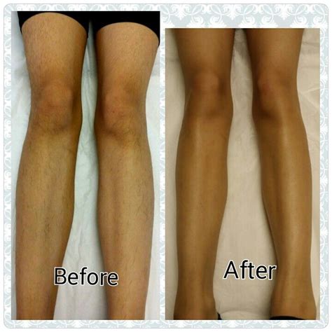 Why are my legs not smooth after waxing?