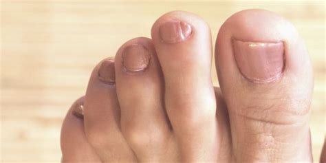 Why are pinky toes weird?