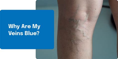 Why are veins blue?