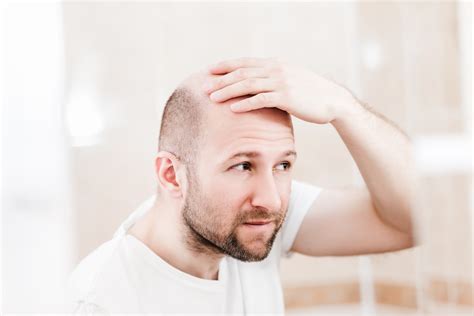 Why can't we cure baldness?