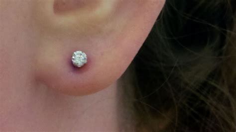Why can I squeeze white stuff from my ear piercing?