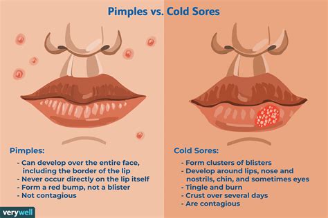 Why did I get a cold sore?
