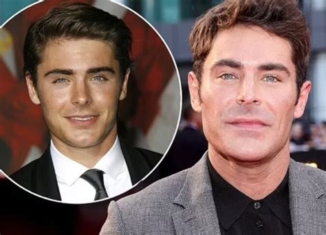 Why did Zac Efron change his jawline?