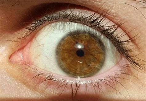 Why did my pupils get so small?