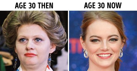 Why do 30 year olds look younger now?