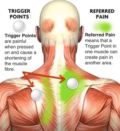 Why do I get knots in my neck?