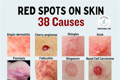 Why do I have a dark red rash?
