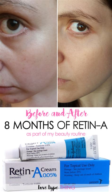 Why do I have more wrinkles after using tretinoin?