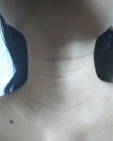 Why do I have neck lines at 15?