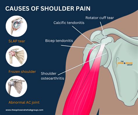 Why do I have pain on the side of my shoulder?