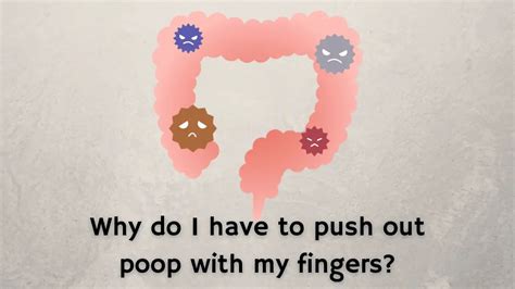 Why do I have to push my poop out with my fingers?