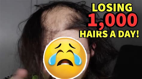 Why do I lose 1,000 hairs a day?