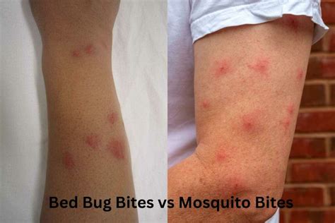 Why do I wake up with mosquito bites?