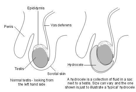 Why do balls go from tight to loose?