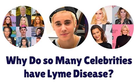 Why do celebrities get Lyme disease?
