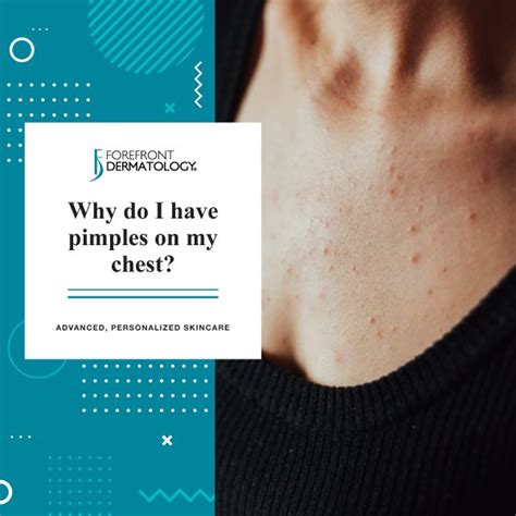 Why do chest pimples hurt to pop?