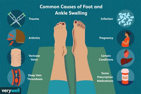 Why do doctors check your ankles?