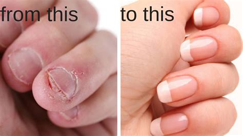 Why do fake nails feel weird?