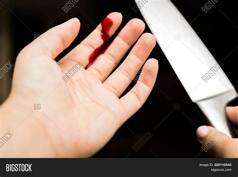 Why do fingers bleed so much when cut?
