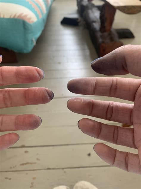 Why do fingers turn black from guitar?