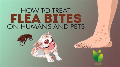 Why do fleas not bother humans?